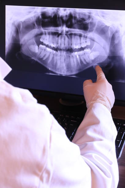 Best Emergency Dental Extractions in Mount Pleasant, UT